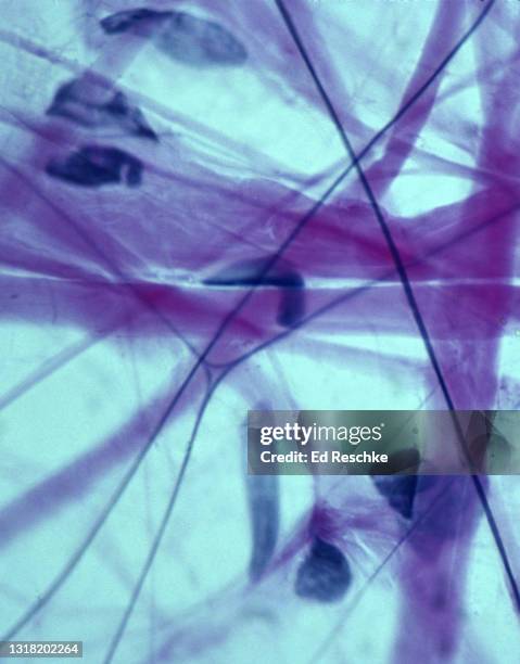 collagenous fibers, elastic fibers and fibroblasts, loose or areolar connective tissue, 250x - elastisch weefsel stockfoto's en -beelden