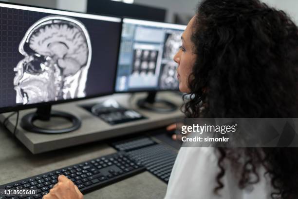 女性放射科醫生分析頭部核磁共振成像 - radiologist 個照片及圖片檔
