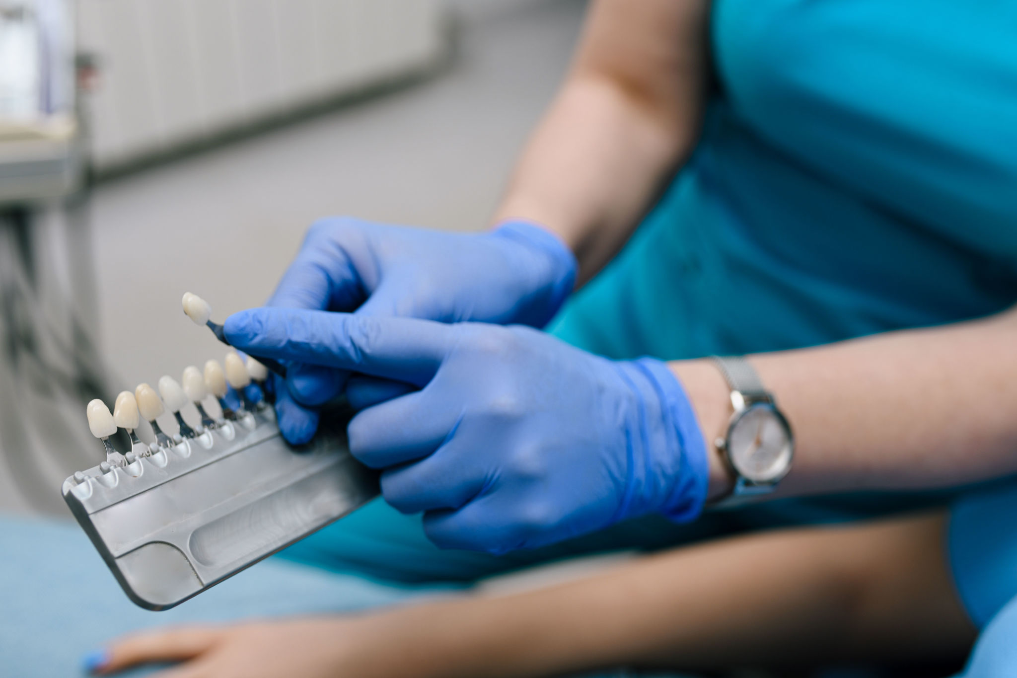 dental veneers