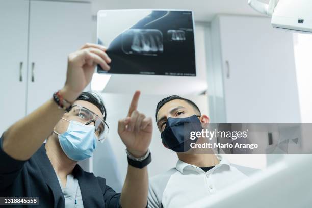 el médico odontólogo revisa la radiografía del diente del paciente antes de entrar a intervenir el procedimiento - radiologia dental fotografías e imágenes de stock