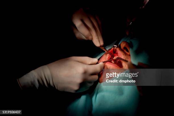 dental intervention surgery - human jaw bone stock pictures, royalty-free photos & images