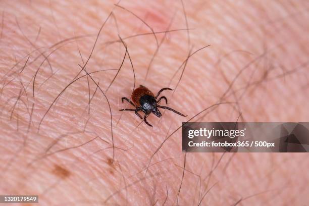 close-up of insect on human hand - lyme disease bite stockfoto's en -beelden