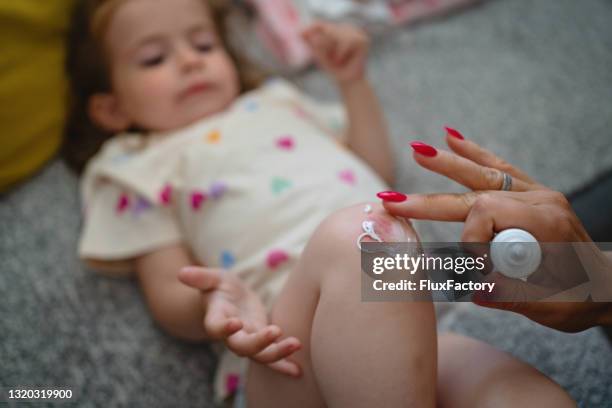 caring mother applying the ointment on her daughter's scratched knee, so the wound can easily heal - scraped knee stock pictures, royalty-free photos & images