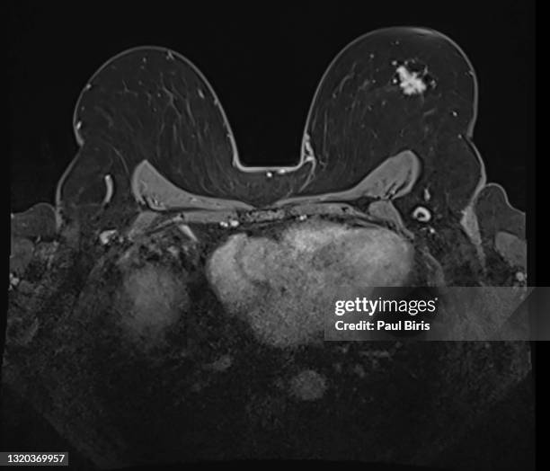 Mri Example Axial 248 Axial Mri Stock Photos, High-Res Pictures, and Images - Getty Images