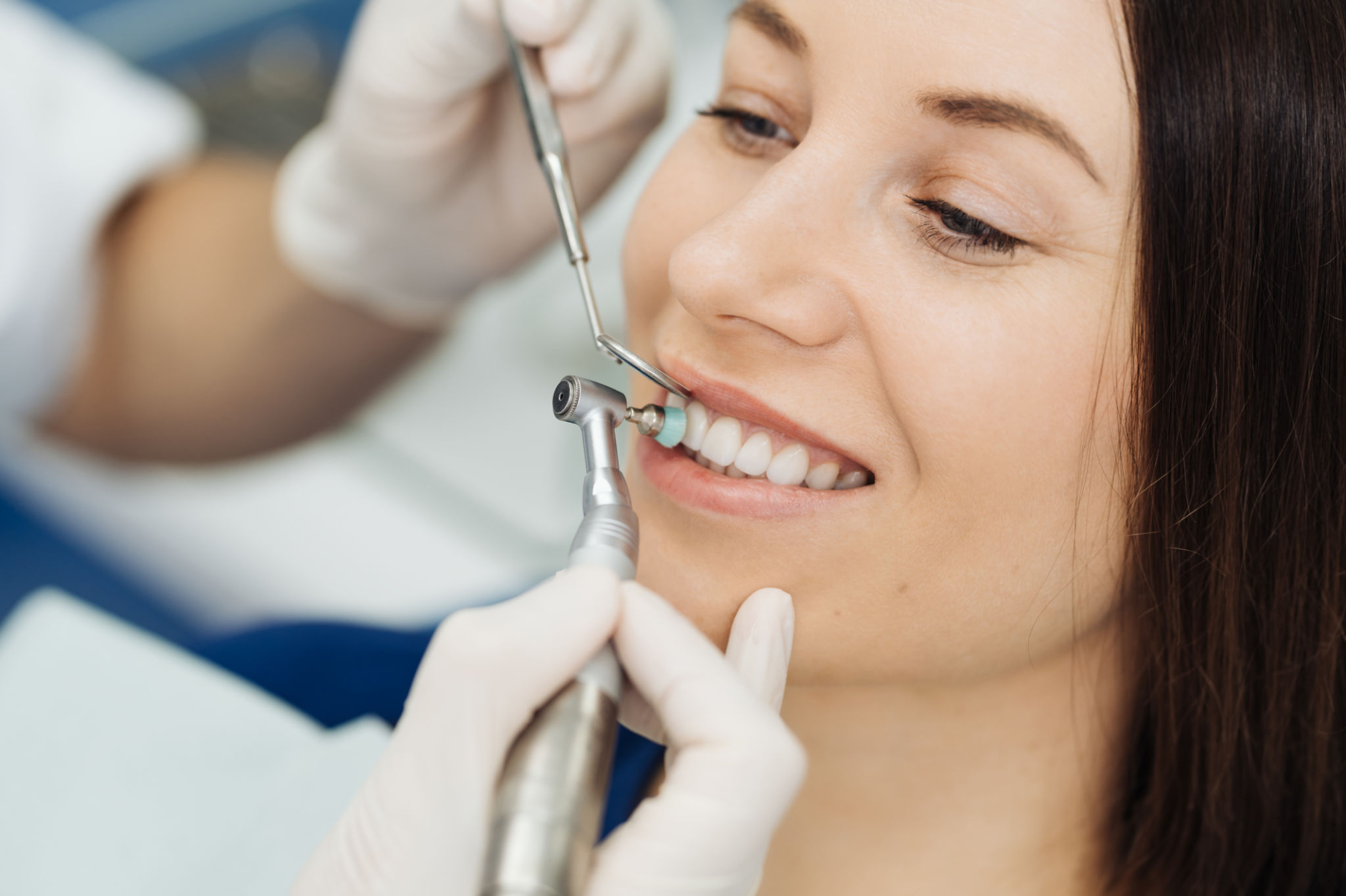 cavities prevention