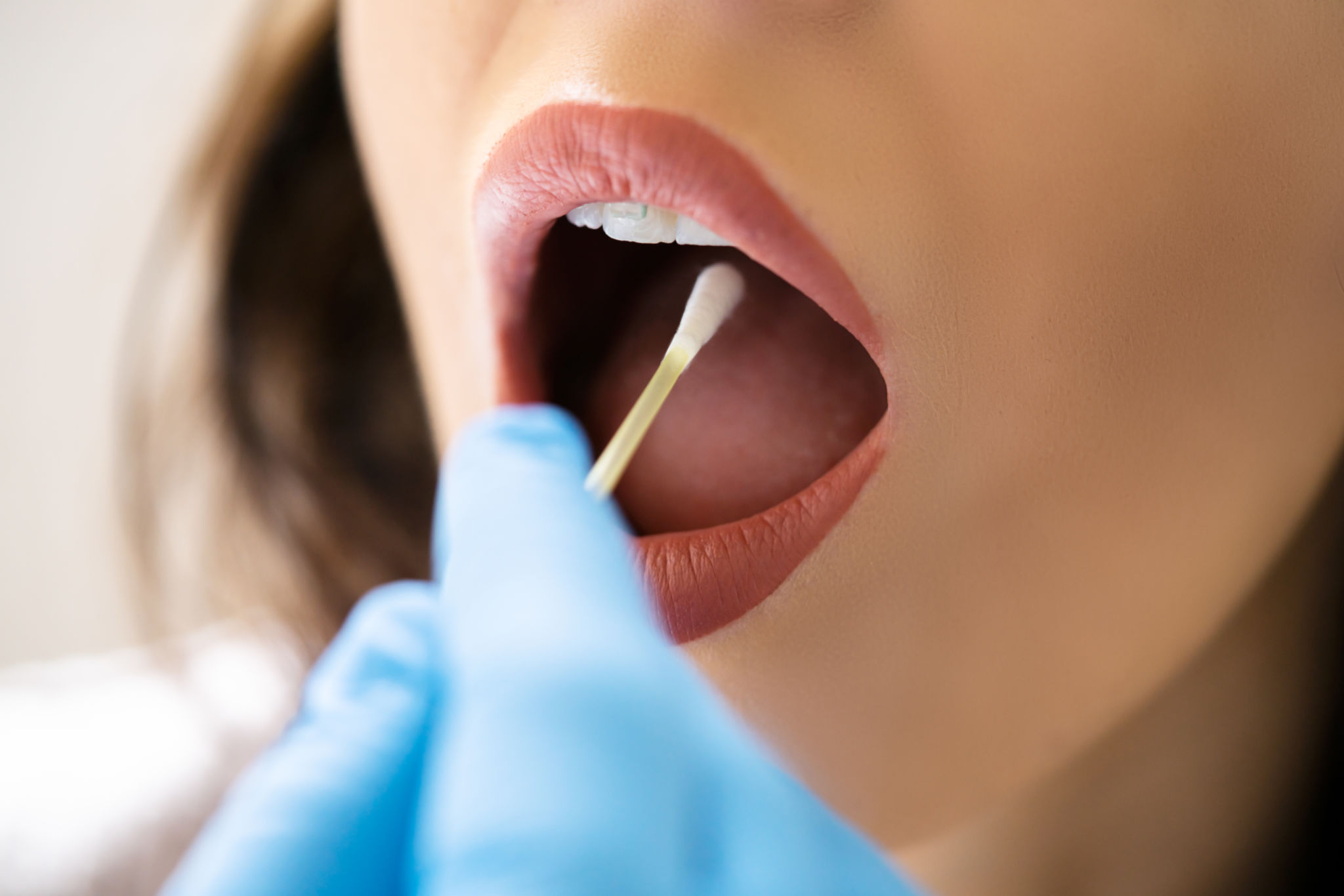 cheek swab sample collection