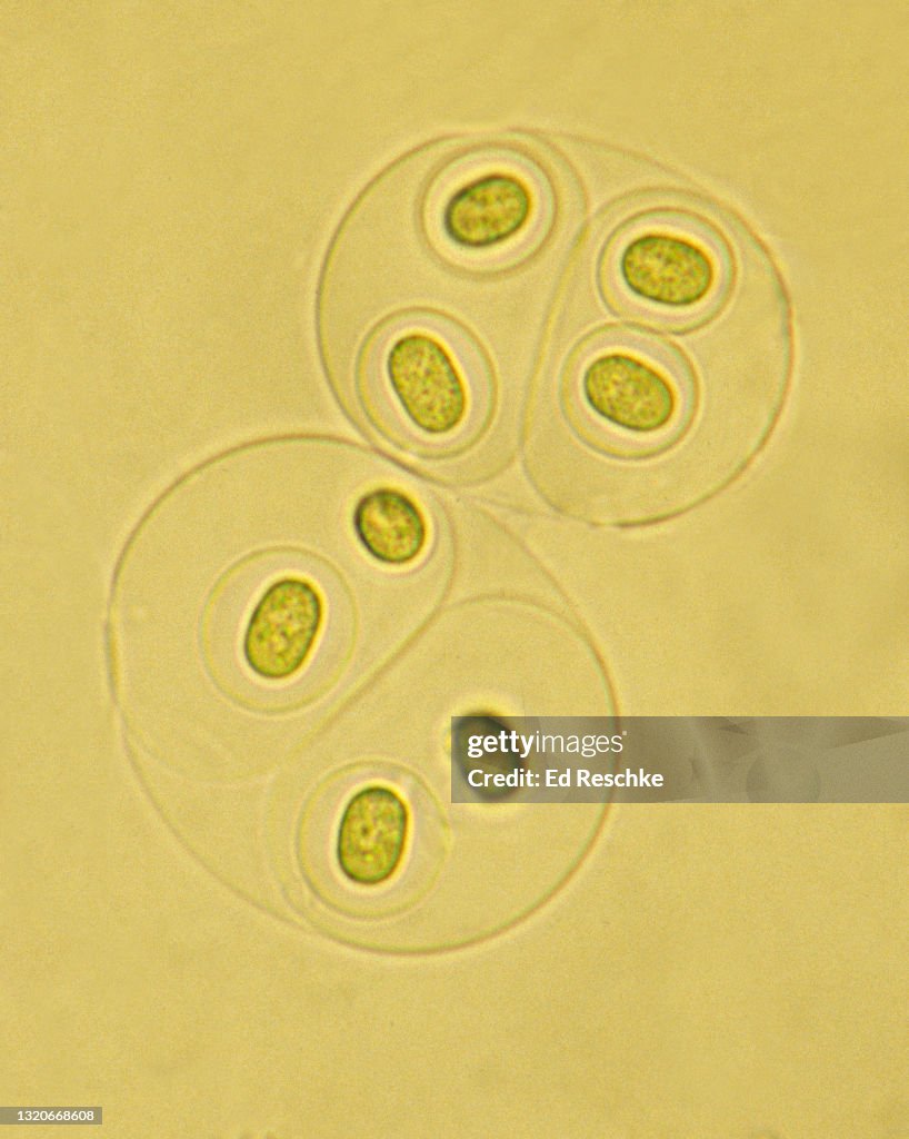 NITROGEN FIXING CYANOBACTERIA (BLUE-GREEN ALGAE), Gloeocapsa, 250X