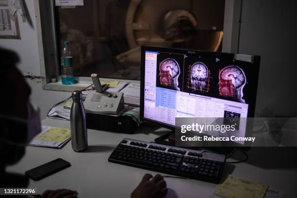 An Indian medical technician examines an MRI scan of patient Laxmi Sharma, who is suffering from mucormycosis, during her scan procedure at the Sawai...