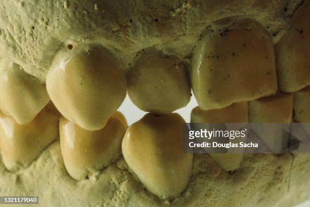 dental plaster cast of human teeth - moulding a shape stock pictures, royalty-free photos & images