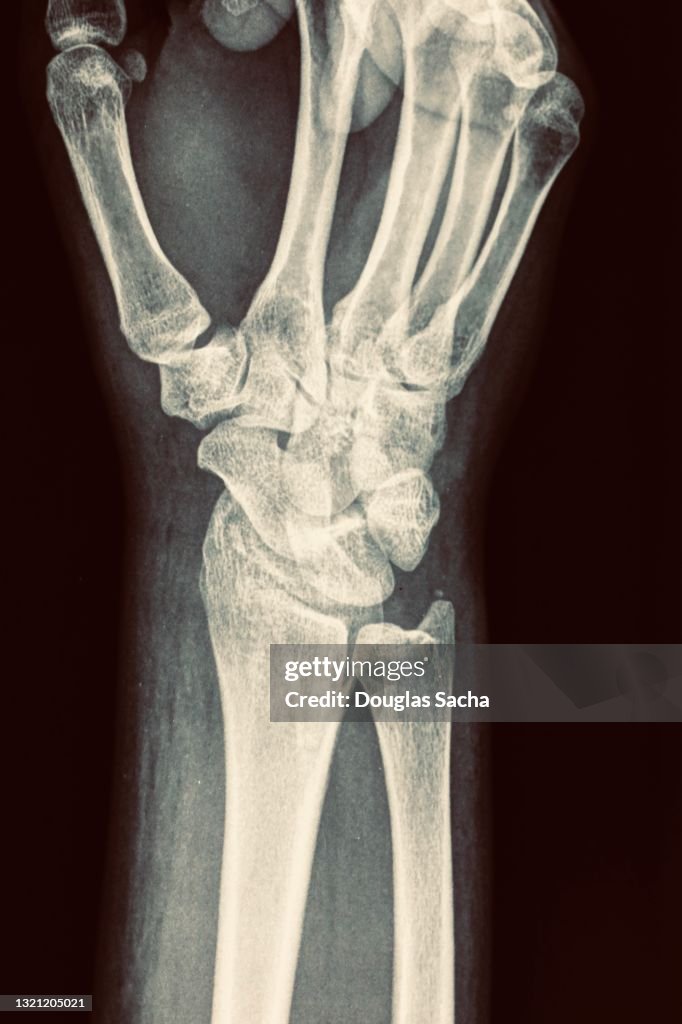 Xray image of the human body