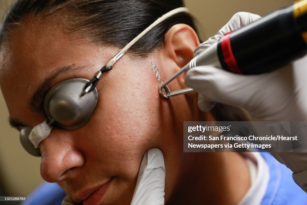 Barbara Schach (right) lasers inmate Jessica Garcia's, 24, face as she undergoes a laser tattoo removal treatment through Inkoff.me at the Folsom women's facility at the Folsom state prison in Folsom, California, on Friday, Sept. 13, 2019.