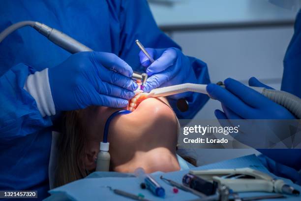 close-up van moderne tandchirurgie - surgical equipment stockfoto's en -beelden