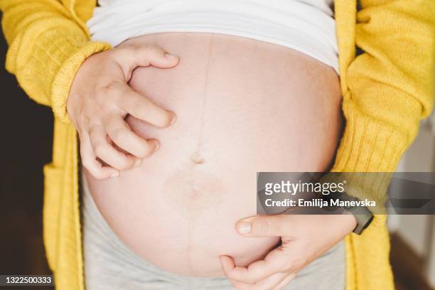 pregnant woman scratching - juckreiz stock-fotos und bilder