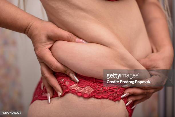woman in bathroom showing cellulite on stomach - cellulit bildbanksfoton och bilder