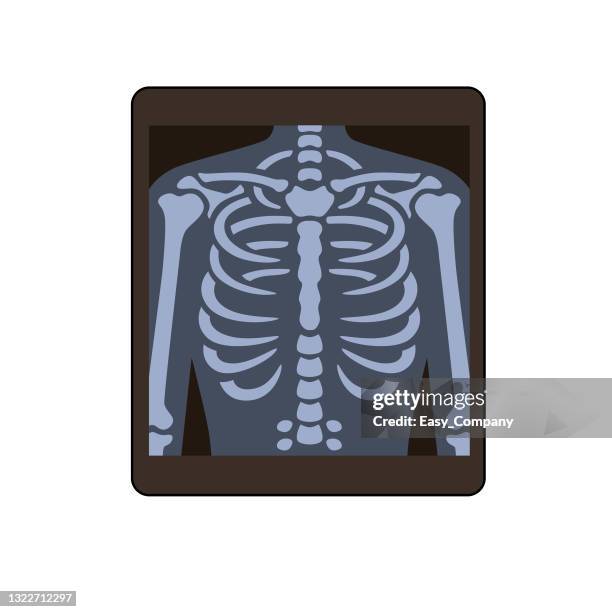 cartoon-röntgenbilder für kinder ist dies eine vektorillustration für vorschul- und heimtraining für eltern und lehrer. - x ray equipment stock-grafiken, -clipart, -cartoons und -symbole