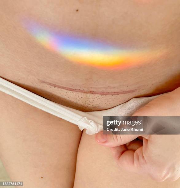 c-section scar and a rainbow on a belly - belly dancer stockfoto's en -beelden