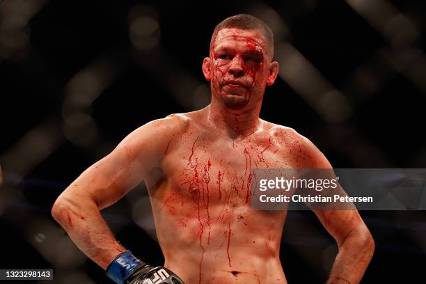 Nate Diaz reacts during his UFC 263 welterweight match against Leon Edwards of Jamaica at Gila River Arena on June 12, 2021 in Glendale, Arizona.