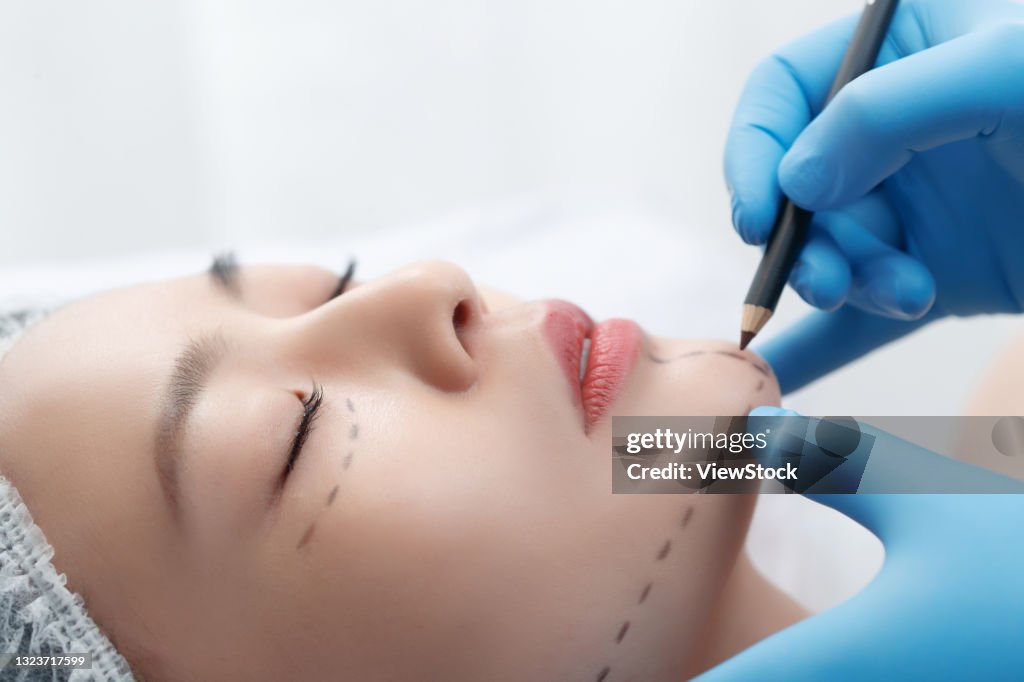 Plastic surgeon in young women draw lines on his face
