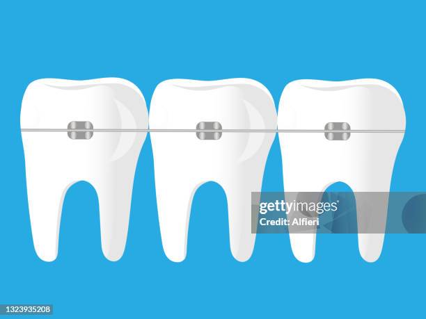 teeth with braces - orthodontic appliance stock illustrations