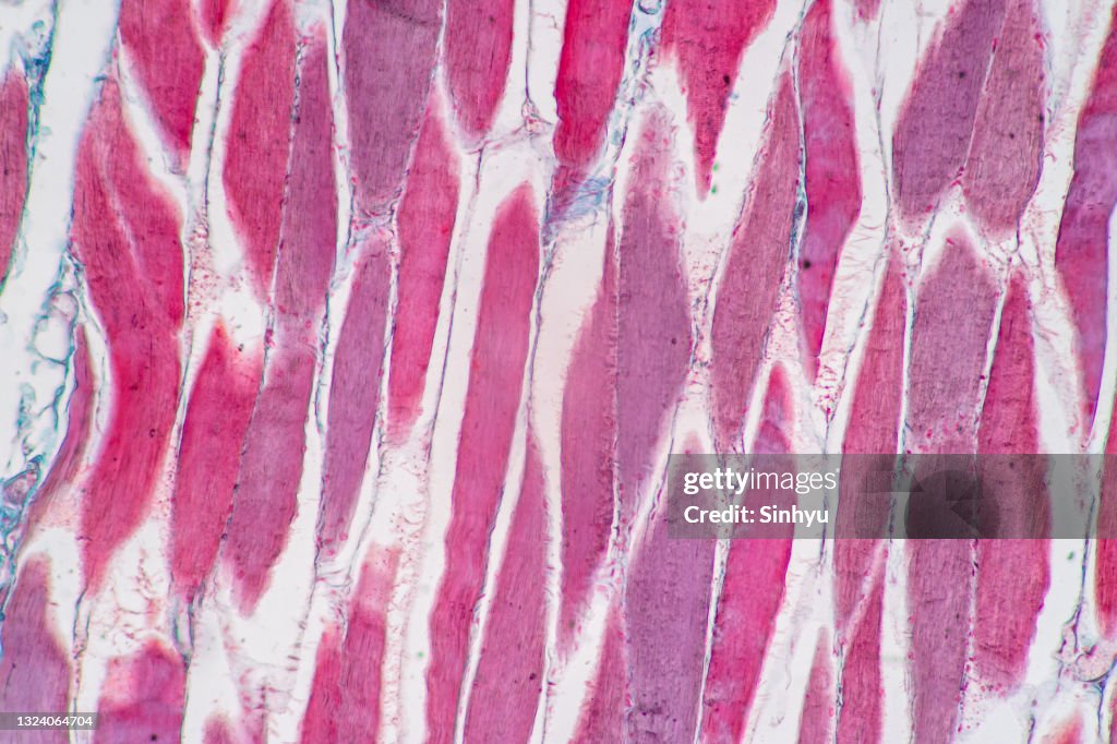 Muscle Tissue Sampling Histological Sample Striated Muscle Of Mammal Tissue Under The ...
