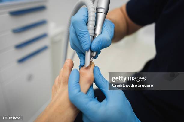 podiatrist cutting toenails and checking their condition - deformed hand stock pictures, royalty-free photos & images