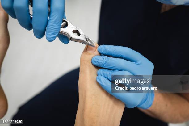 podiatrist cutting toenails and checking their condition - deformed hand stock pictures, royalty-free photos & images