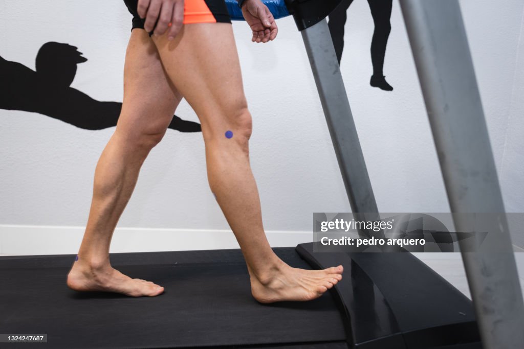 Podiatrist checking the footprint of a patient walking on an electrical treadmill