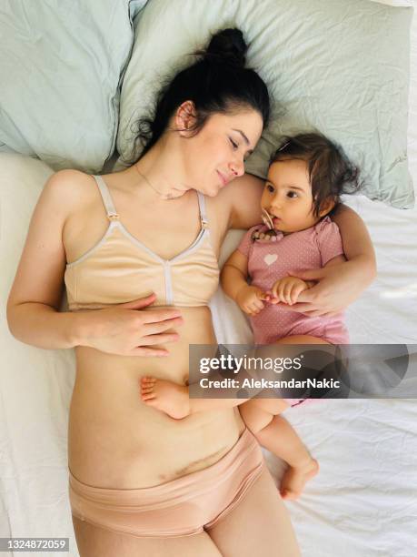 mother with c-section scar and her baby lying on the bed - scar stock pictures, royalty-free photos & images