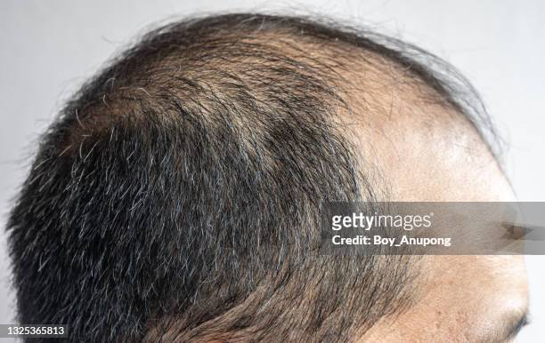 close up view of asian male head with few gray hair growing. - man with gray hair stock pictures, royalty-free photos & images