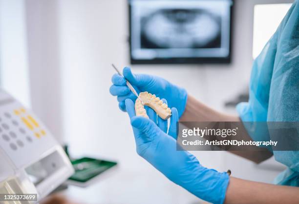 zahnputzform in den händen des zahnarztes - crown molding stock-fotos und bilder