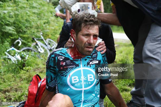 Cyril Lemoine of France and Team B&B Hotels p/b KTM injury after crash during during the 108th Tour de France 2021, Stage 1 a 197,8km stage from...