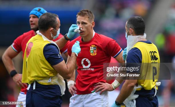 Lions player Liam Williams is treated for a facial injury by the medic during the 1888 Cup match between the British & Irish Lions and Japan at BT...