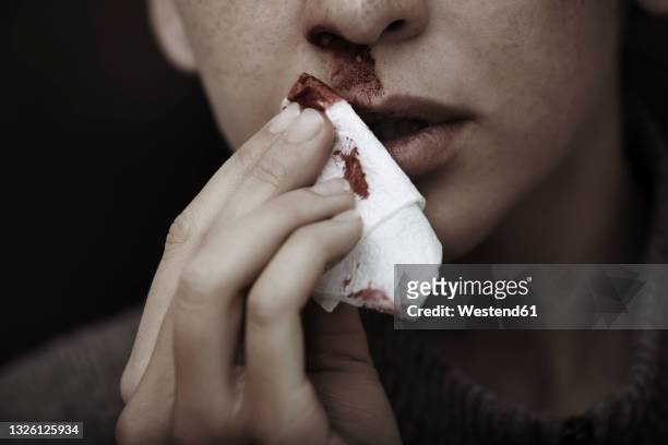 mid adult woman with bloody nose holding tissue paper - nose bleed stock pictures, royalty-free photos & images