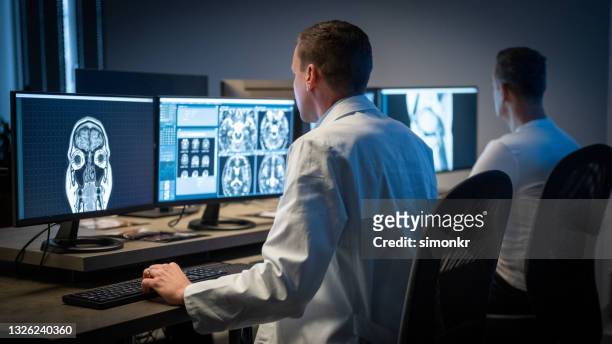 männlicher radiologe analysiert das mrt-bild des kopfes - neurowissenschaften stock-fotos und bilder