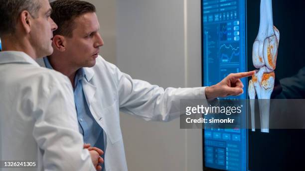 ライトボックス上の膝のmri画像を検査する男性放射線科医 - 四肢 ストックフォトと画像