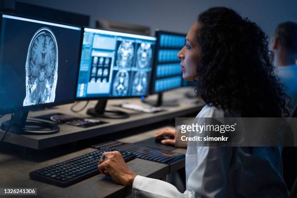 female radiologist analysing the mri image of the head - brain stockfoto's en -beelden