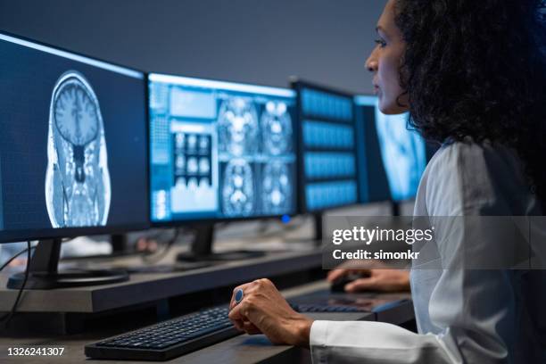 radiologin analysiert das mrt-bild des kopfes - neurosurgery stock-fotos und bilder