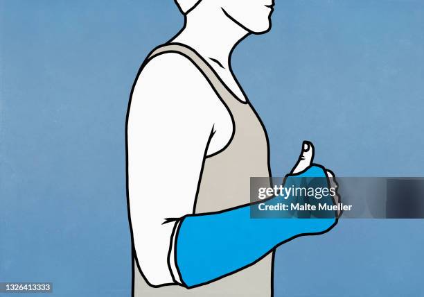 man with arm in cast gesturing thumbs up - broken arm stock illustrations
