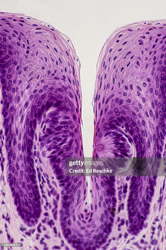 TASTE BUD--Contains TASTE RECEPTORS (SENSORY RECEPTORS or Chemoreceptors), TONGUE, 100X