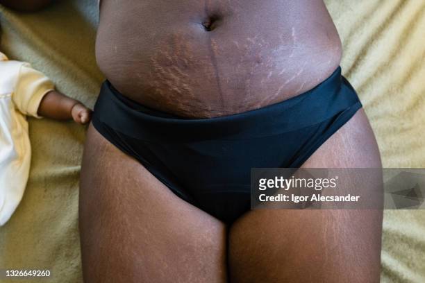 postpartum stretch marks on the belly - black pants stock pictures, royalty-free photos & images