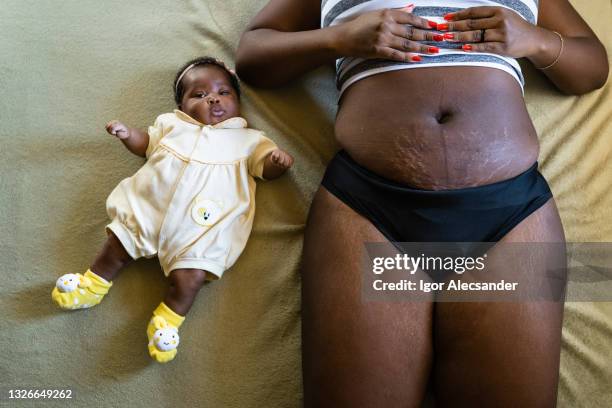 baby beside the mother with scars and marks on the belly - caesarean section stock pictures, royalty-free photos & images