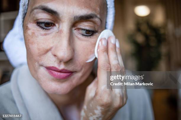 eine frau, die sich während ihres aufenthalts zu hause um ihre schönheit kümmert. vitiligo. - vitiligo stock-fotos und bilder