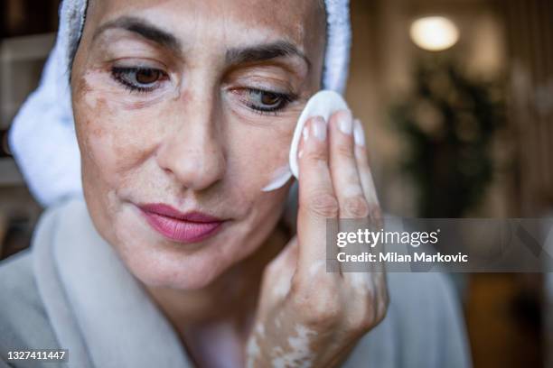 a woman who takes care of her beauty during her stay at home. vitiligo. - vitiligo stock pictures, royalty-free photos & images