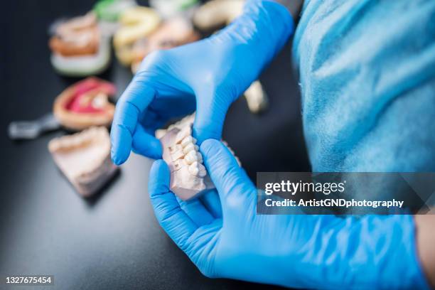 dental plaster mould in the hands of the dentist - crown molding 個照片及圖片檔