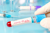 Doctor with a positive blood sample for the new variant detected of the coronavirus strain called covid DELTA. Research of new strains and mutations of Covid 19 coronavirus in the laboratory