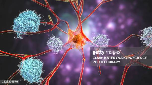 nerve cells affected by alzheimer's disease, illustration - microglia stock illustrations