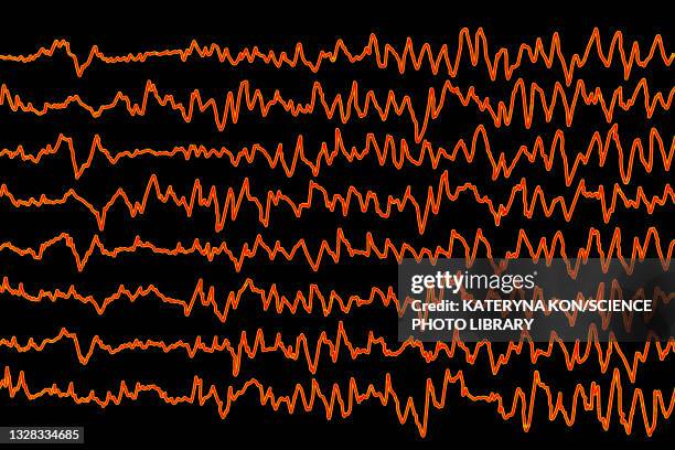 brain waves in migraine, illustration - eeg stock illustrations