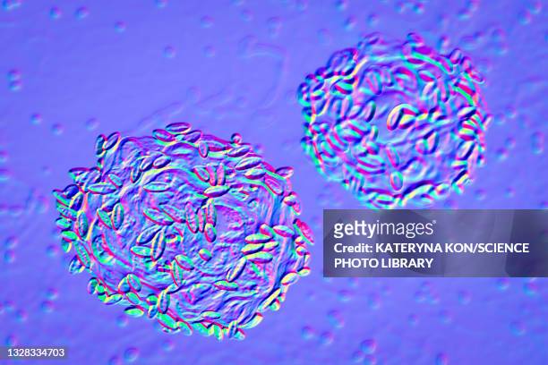 bacterial vaginosis, illustration - cervical pap smear stock illustrations