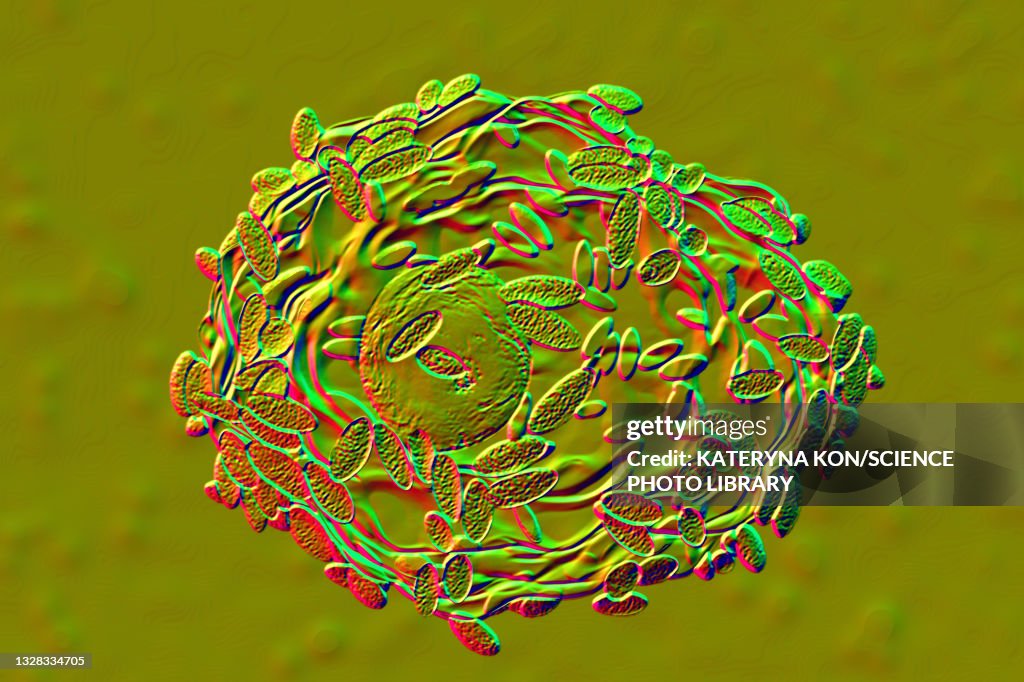 Bacterial vaginosis, illustration