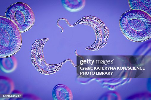 Sleeping sickness parasite, illustration Sleeping sickness parasite, illustration